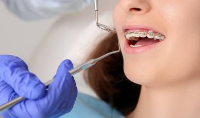 Ortodontinis gydymas